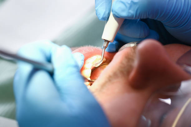 Best Emergency Treatment for Oral Infections in Greentree, NJ